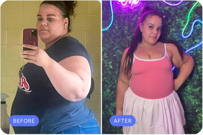 BetterMe Rx patient before and after transformation