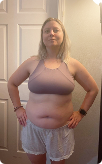 Kayla O. before